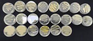 Una matriz de veintiún placas de Petri que contienen cultivos bacterianos o fúngicos, mostrando colonias de diferentes texturas y colores